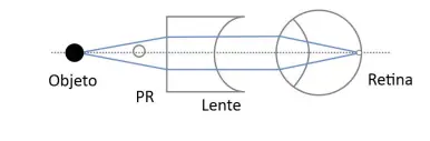 Alternativa A
