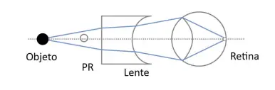 Alternativa B