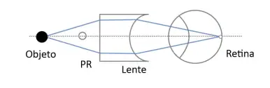 Alternativa E
